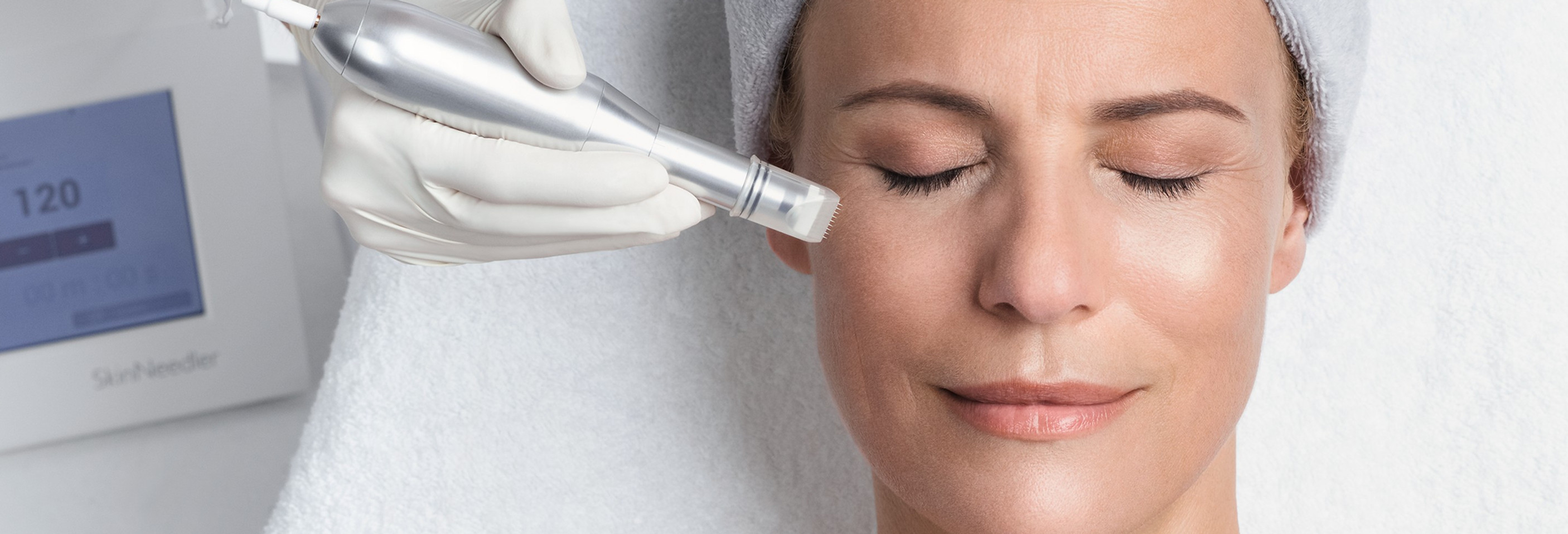 Microneedling Behandlung in Augsburg