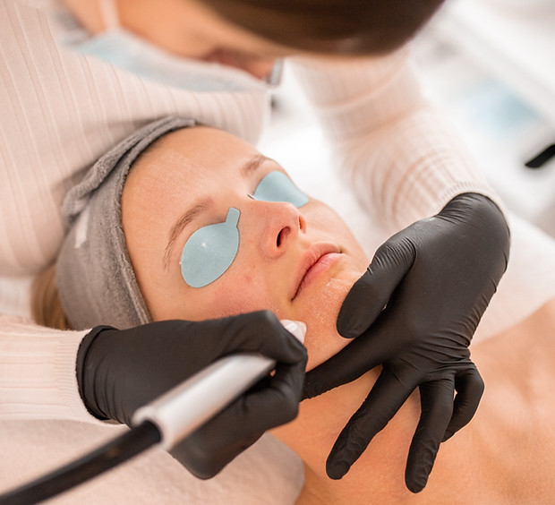 Mikrodermabrasion Behandlung bei bareSkin